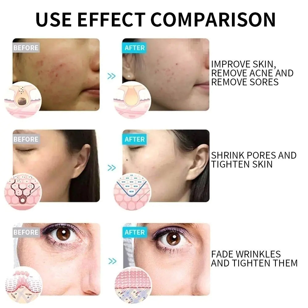 LED Facial Light Therapy Mask - 7 Color Photon Skin Care Mask with Neck Attachment for Face & Neck, Professional Beauty Device for Anti-Aging, Acne Treatment, Skin Tightening & Rejuvenation